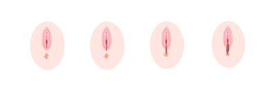 Dammriss illustriert